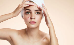 Skin specialist examining a patient's skin condition during professional consultation
